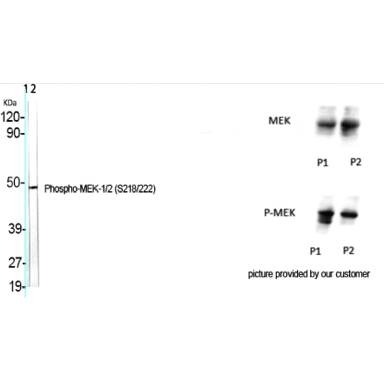 Western Blot - Anti-MEK1 + MEK2 (phospho Ser217) Antibody (A7146) - Antibodies.com