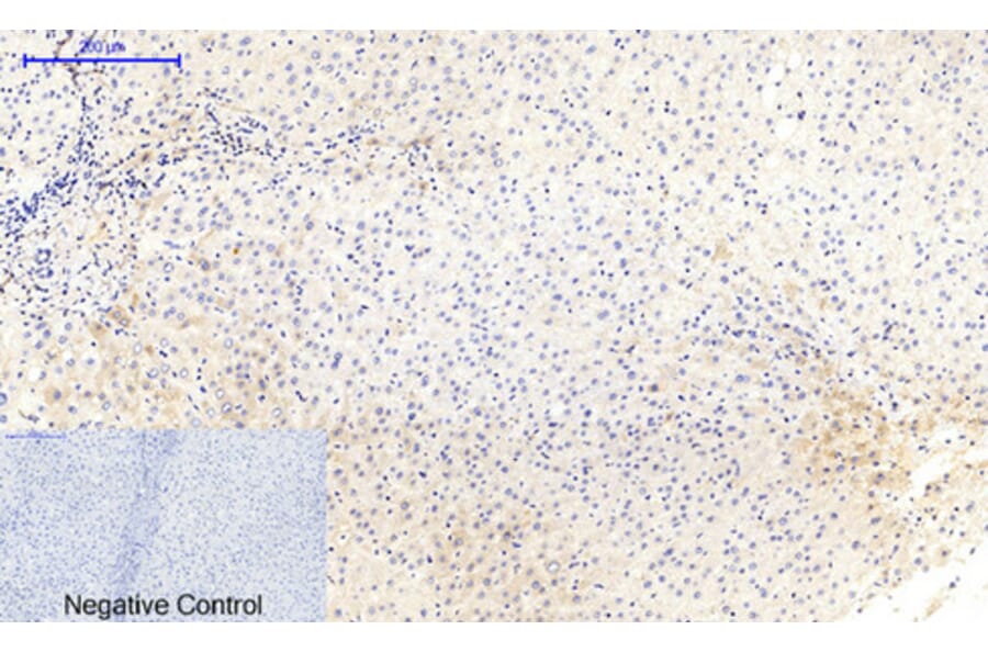 Immunohistochemistry - Anti-MEK1 + MEK2 (phospho Ser217) Antibody (A7146) - Antibodies.com