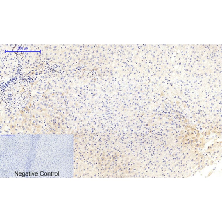 Immunohistochemistry - Anti-MEK1 + MEK2 (phospho Ser217) Antibody (A7146) - Antibodies.com