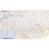 Immunohistochemistry - Anti-MEK1 + MEK2 (phospho Ser217) Antibody (A7146) - Antibodies.com