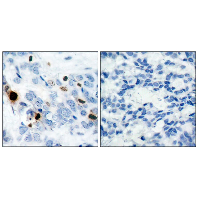 Immunohistochemistry - Anti-Histone H3.1 (phospho Ser10) Antibody (A7107) - Antibodies.com