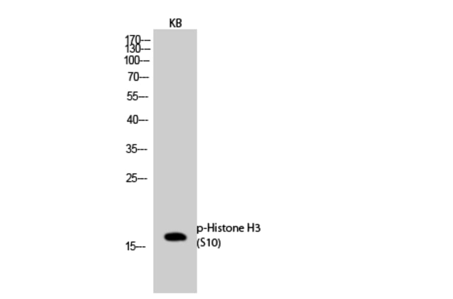 Western Blot - Anti-Histone H3.1 (phospho Ser10) Antibody (A7107) - Antibodies.com