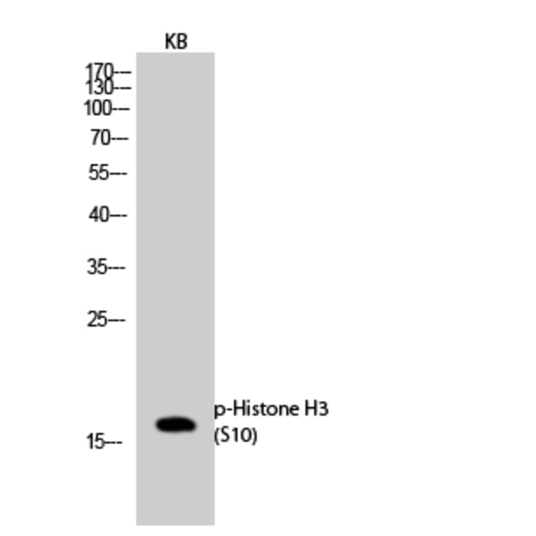 Western Blot - Anti-Histone H3.1 (phospho Ser10) Antibody (A7107) - Antibodies.com