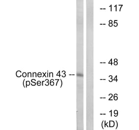 Western Blot - Anti-Connexin 43 (phospho Ser367) Antibody (A7048) - Antibodies.com