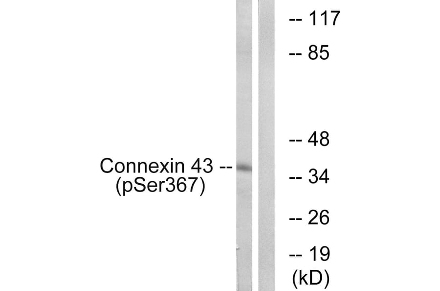 Western Blot - Anti-Connexin 43 (phospho Ser367) Antibody (A7048) - Antibodies.com