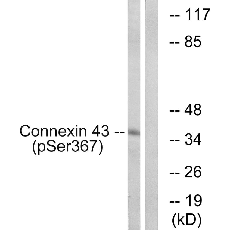 Western Blot - Anti-Connexin 43 (phospho Ser367) Antibody (A7048) - Antibodies.com
