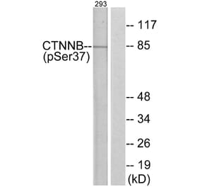 Western Blot - Anti-Catenin-beta (phospho Ser37) Antibody (A7023) - Antibodies.com