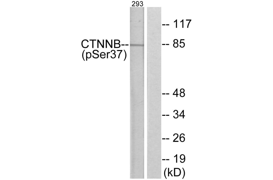 Western Blot - Anti-Catenin-beta (phospho Ser37) Antibody (A7023) - Antibodies.com