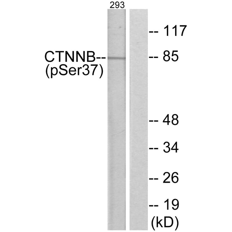 Western Blot - Anti-Catenin-beta (phospho Ser37) Antibody (A7023) - Antibodies.com