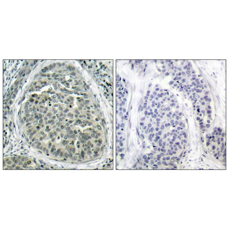 Immunohistochemistry - Anti-Catenin-beta (phospho Ser37) Antibody (A7023) - Antibodies.com