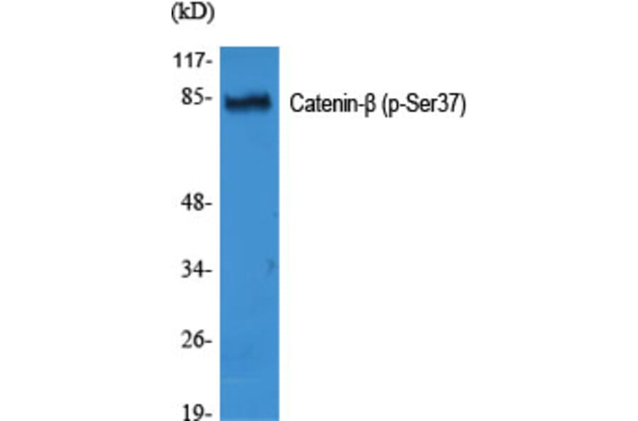 Western Blot - Anti-Catenin-beta (phospho Ser37) Antibody (A7023) - Antibodies.com