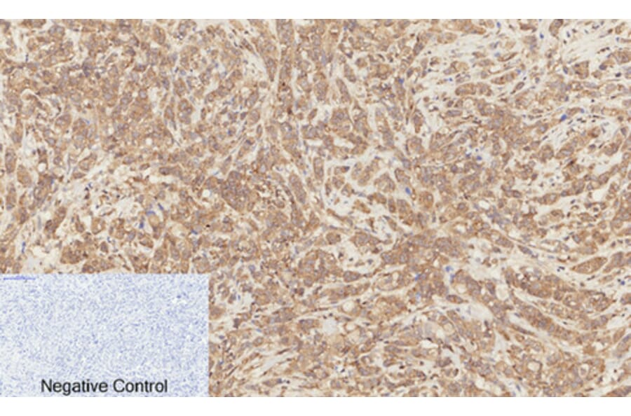 Immunohistochemistry - Anti-Catenin-beta (phospho Ser37) Antibody (A7023) - Antibodies.com