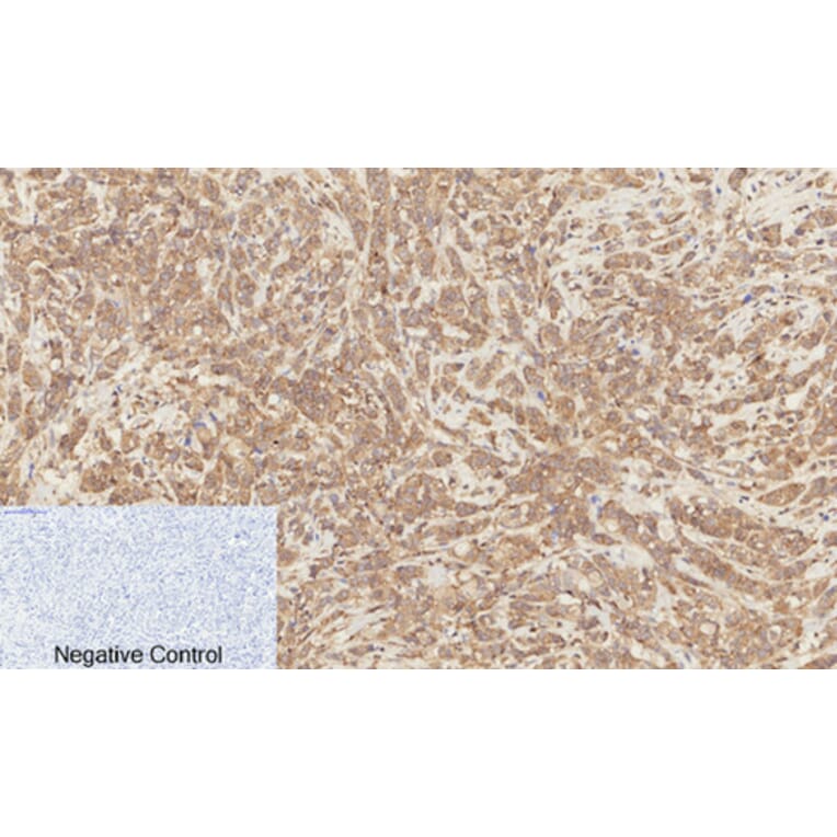 Immunohistochemistry - Anti-Catenin-beta (phospho Ser37) Antibody (A7023) - Antibodies.com