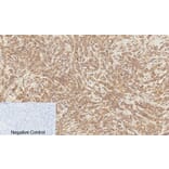 Immunohistochemistry - Anti-Catenin-beta (phospho Ser37) Antibody (A7023) - Antibodies.com