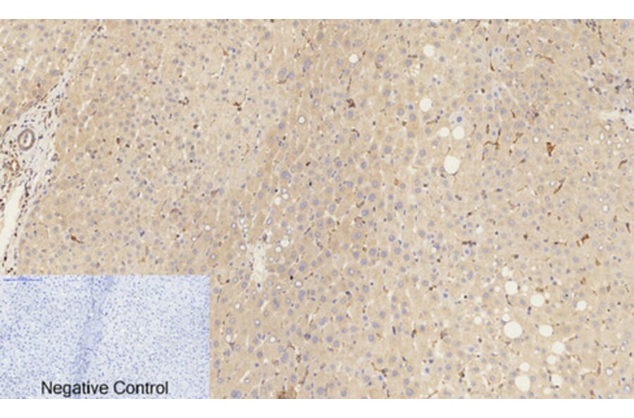 Immunohistochemistry - Anti-Catenin-beta (phospho Ser37) Antibody (A7023) - Antibodies.com