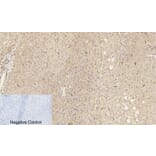 Immunohistochemistry - Anti-Catenin-beta (phospho Ser37) Antibody (A7023) - Antibodies.com