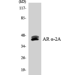 Western Blot - Anti-Adrenergic Receptor alpha-2A Antibody (R12-2458) - Antibodies.com