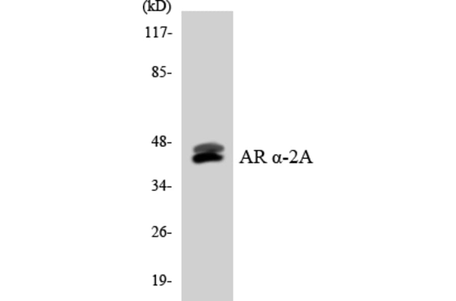 Western Blot - Anti-Adrenergic Receptor alpha-2A Antibody (R12-2458) - Antibodies.com