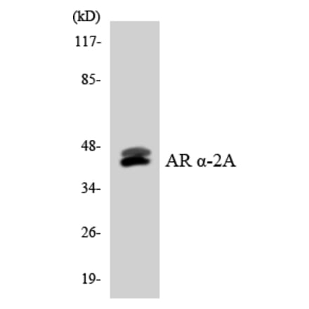 Western Blot - Anti-Adrenergic Receptor alpha-2A Antibody (R12-2458) - Antibodies.com