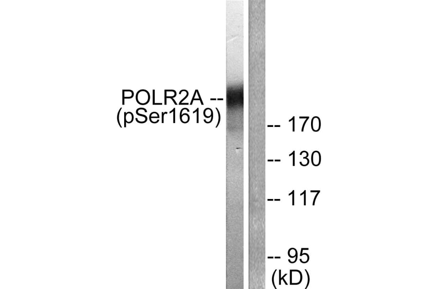 Western Blot - Anti-POLR2A (phospho Ser1619) Antibody (A0082) - Antibodies.com