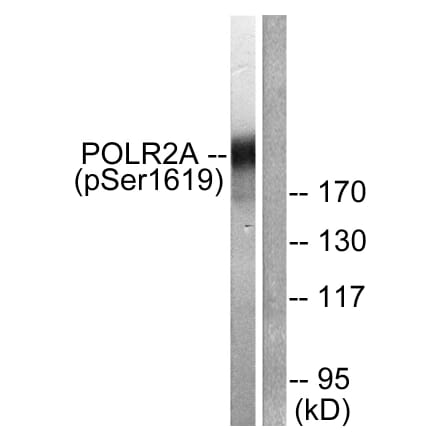Western Blot - Anti-POLR2A (phospho Ser1619) Antibody (A0082) - Antibodies.com