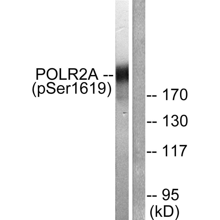 Western Blot - Anti-POLR2A (phospho Ser1619) Antibody (A0082) - Antibodies.com