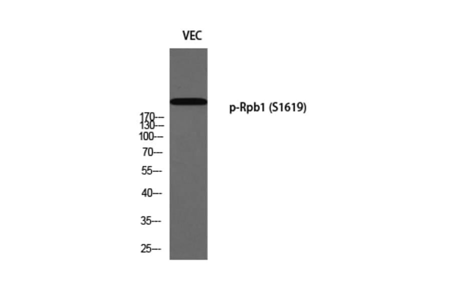 Western Blot - Anti-POLR2A (phospho Ser1619) Antibody (A0082) - Antibodies.com