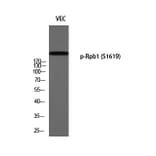 Western Blot - Anti-POLR2A (phospho Ser1619) Antibody (A0082) - Antibodies.com