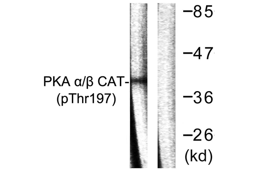 Western Blot - Anti-PKA CAT (phospho Thr197) Antibody (A0548) - Antibodies.com