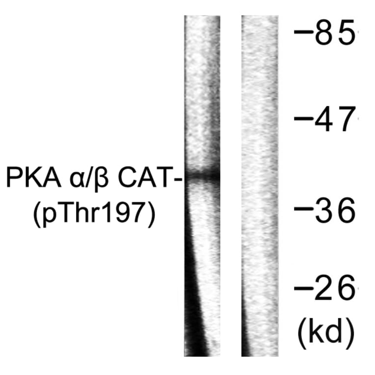 Western Blot - Anti-PKA CAT (phospho Thr197) Antibody (A0548) - Antibodies.com