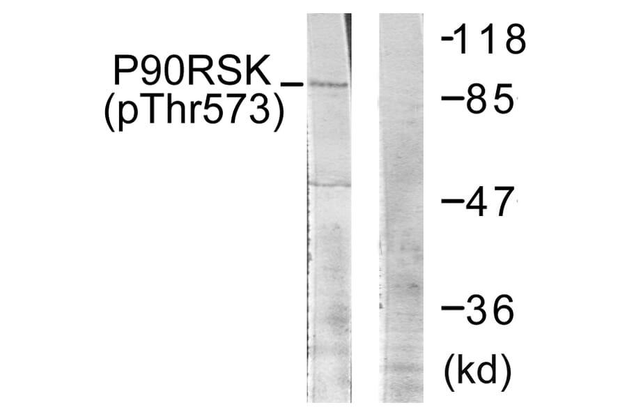 Western Blot - Anti-p90 RSK (phospho Thr573) Antibody (A0537) - Antibodies.com