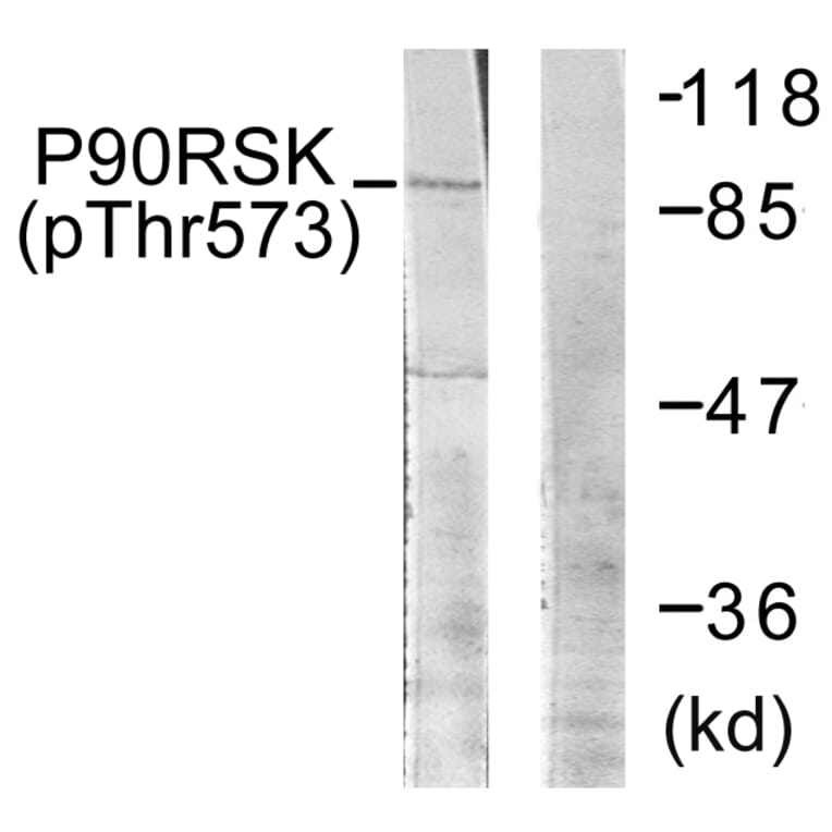Western Blot - Anti-p90 RSK (phospho Thr573) Antibody (A0537) - Antibodies.com