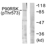 Western Blot - Anti-p90 RSK (phospho Thr573) Antibody (A0537) - Antibodies.com