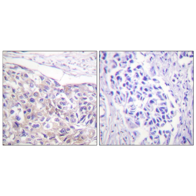 Immunohistochemistry - Anti-p90 RSK (phospho Thr573) Antibody (A0537) - Antibodies.com