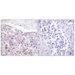 Immunohistochemistry - Anti-p90 RSK (phospho Thr573) Antibody (A0537) - Antibodies.com
