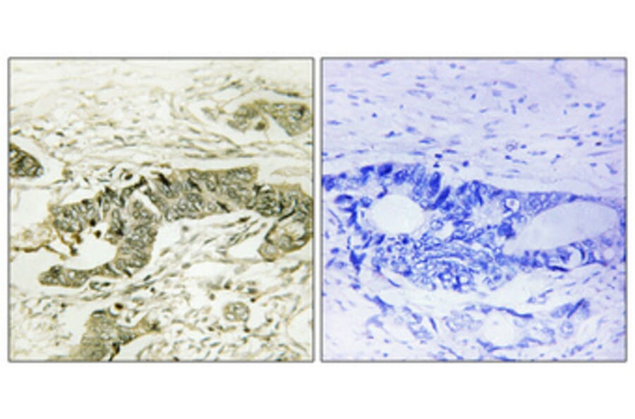 Immunohistochemistry - Anti-p90 RSK (phospho Thr573) Antibody (A0537) - Antibodies.com