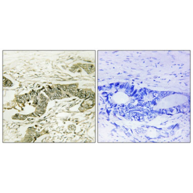 Immunohistochemistry - Anti-p90 RSK (phospho Thr573) Antibody (A0537) - Antibodies.com
