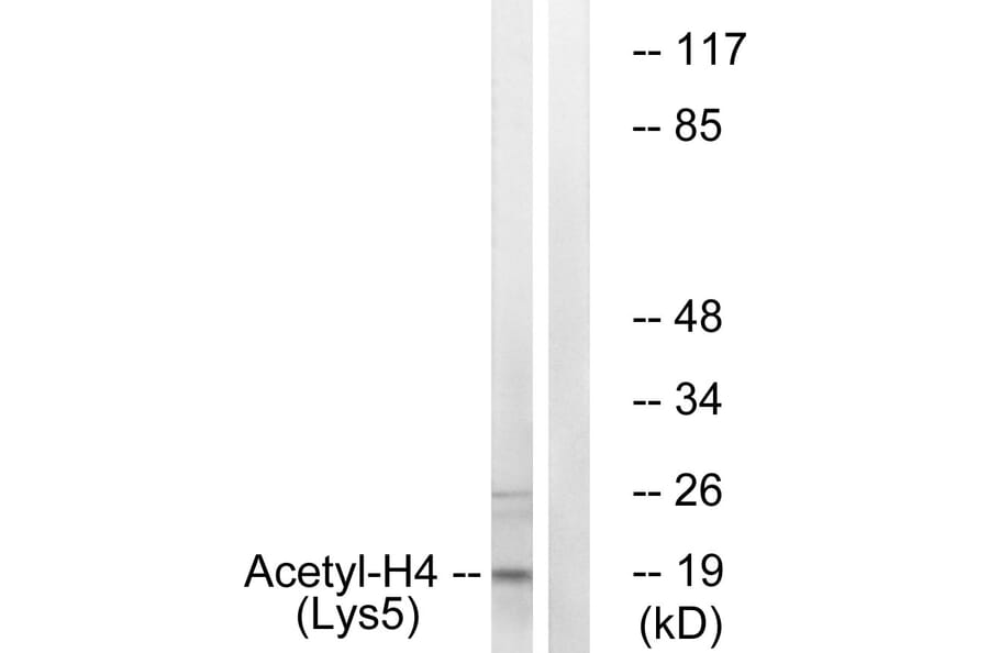 Western Blot - Anti-Histone H4 (acetyl Lys5) Antibody (D0011) - Antibodies.com