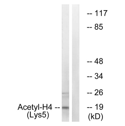 Western Blot - Anti-Histone H4 (acetyl Lys5) Antibody (D0011) - Antibodies.com