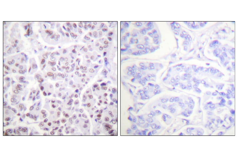 Immunohistochemistry - Anti-Histone H4 (acetyl Lys5) Antibody (D0011) - Antibodies.com