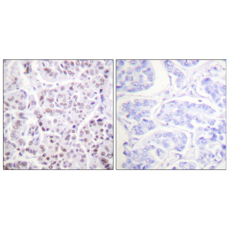 Immunohistochemistry - Anti-Histone H4 (acetyl Lys5) Antibody (D0011) - Antibodies.com