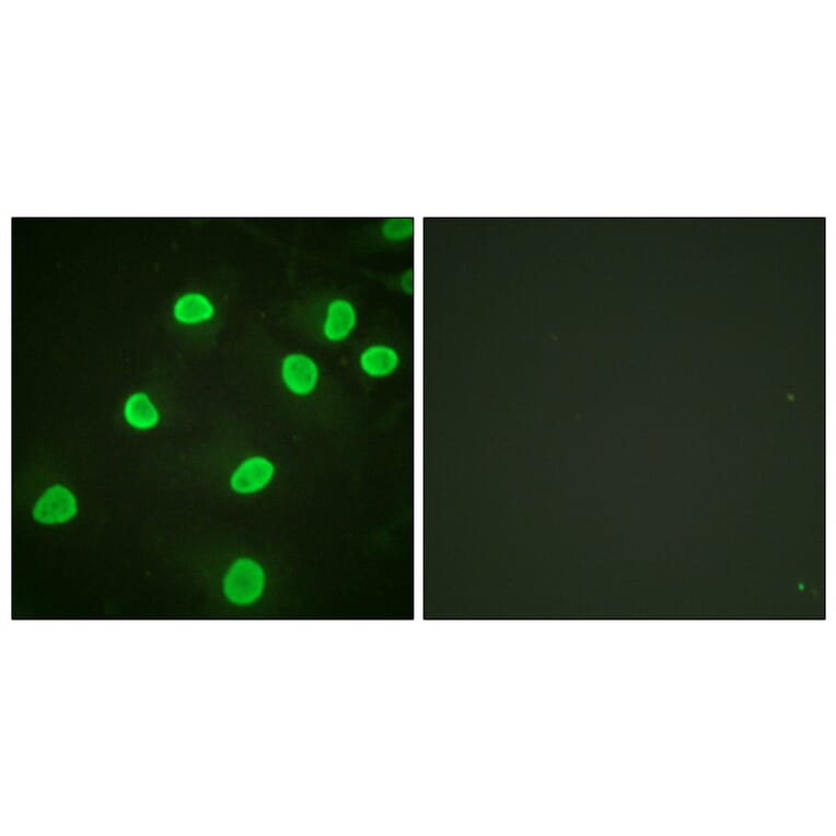 Immunofluorescence - Anti-Histone H4 (acetyl Lys5) Antibody (D0011) - Antibodies.com