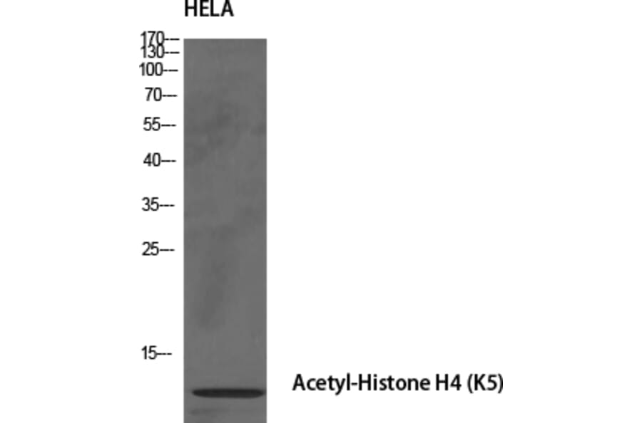 Western Blot - Anti-Histone H4 (acetyl Lys5) Antibody (D0011) - Antibodies.com