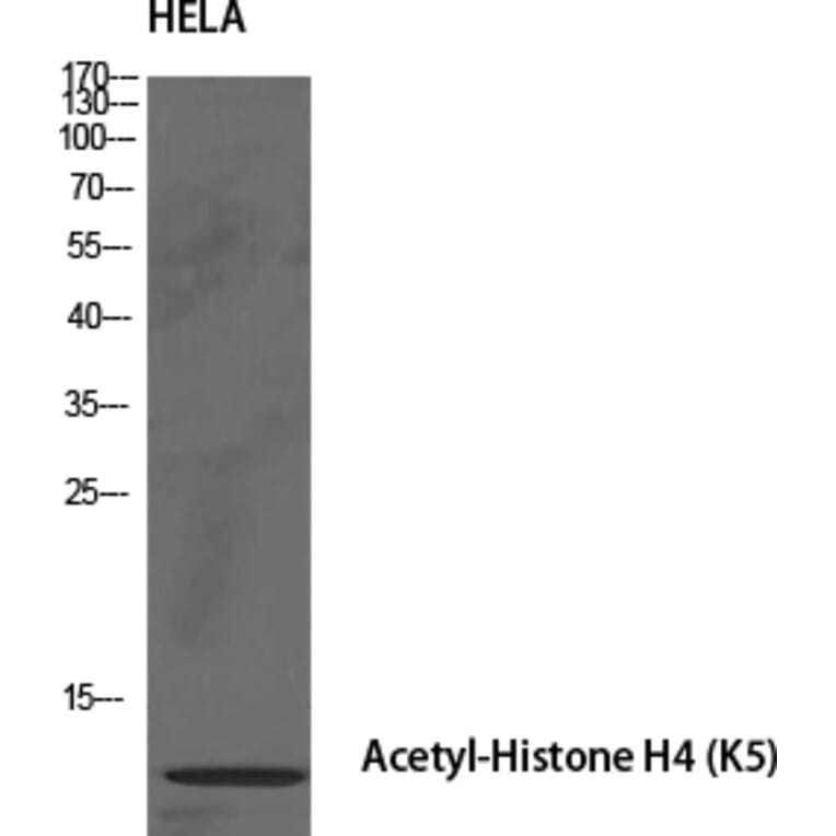 Western Blot - Anti-Histone H4 (acetyl Lys5) Antibody (D0011) - Antibodies.com
