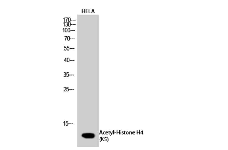 Western Blot - Anti-Histone H4 (acetyl Lys5) Antibody (D0011) - Antibodies.com