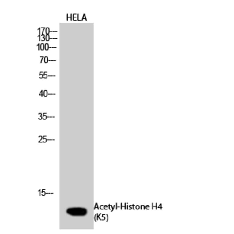 Western Blot - Anti-Histone H4 (acetyl Lys5) Antibody (D0011) - Antibodies.com