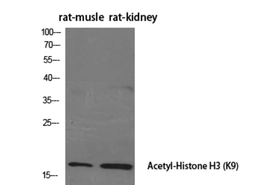 Western Blot - Anti-Histone H3 (acetyl Lys9) Antibody (D0006) - Antibodies.com
