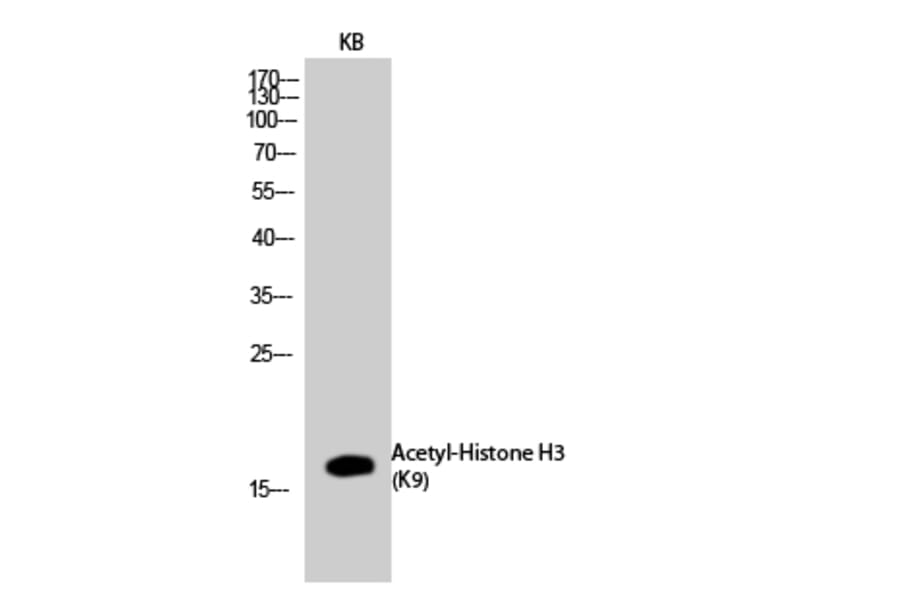 Western Blot - Anti-Histone H3 (acetyl Lys9) Antibody (D0006) - Antibodies.com