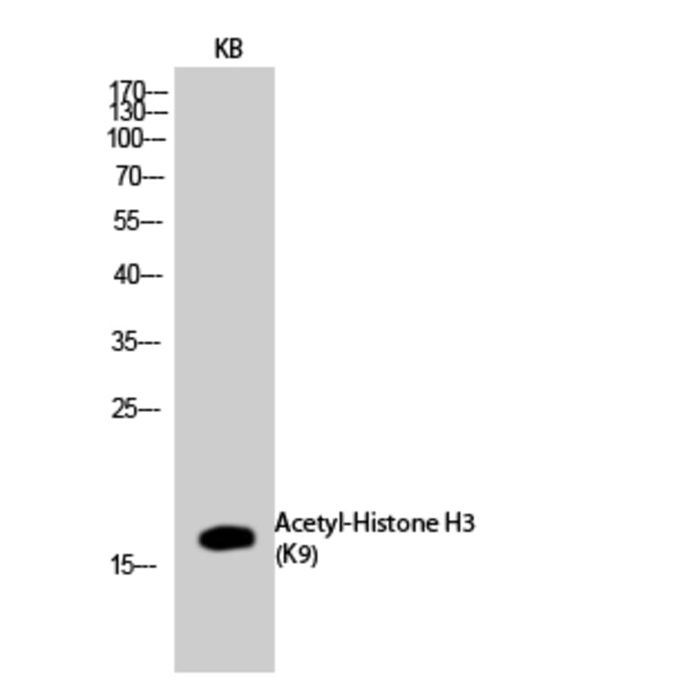 Western Blot - Anti-Histone H3 (acetyl Lys9) Antibody (D0006) - Antibodies.com