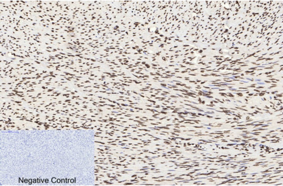 Immunohistochemistry - Anti-Histone H3 (acetyl Lys9) Antibody (D0006) - Antibodies.com
